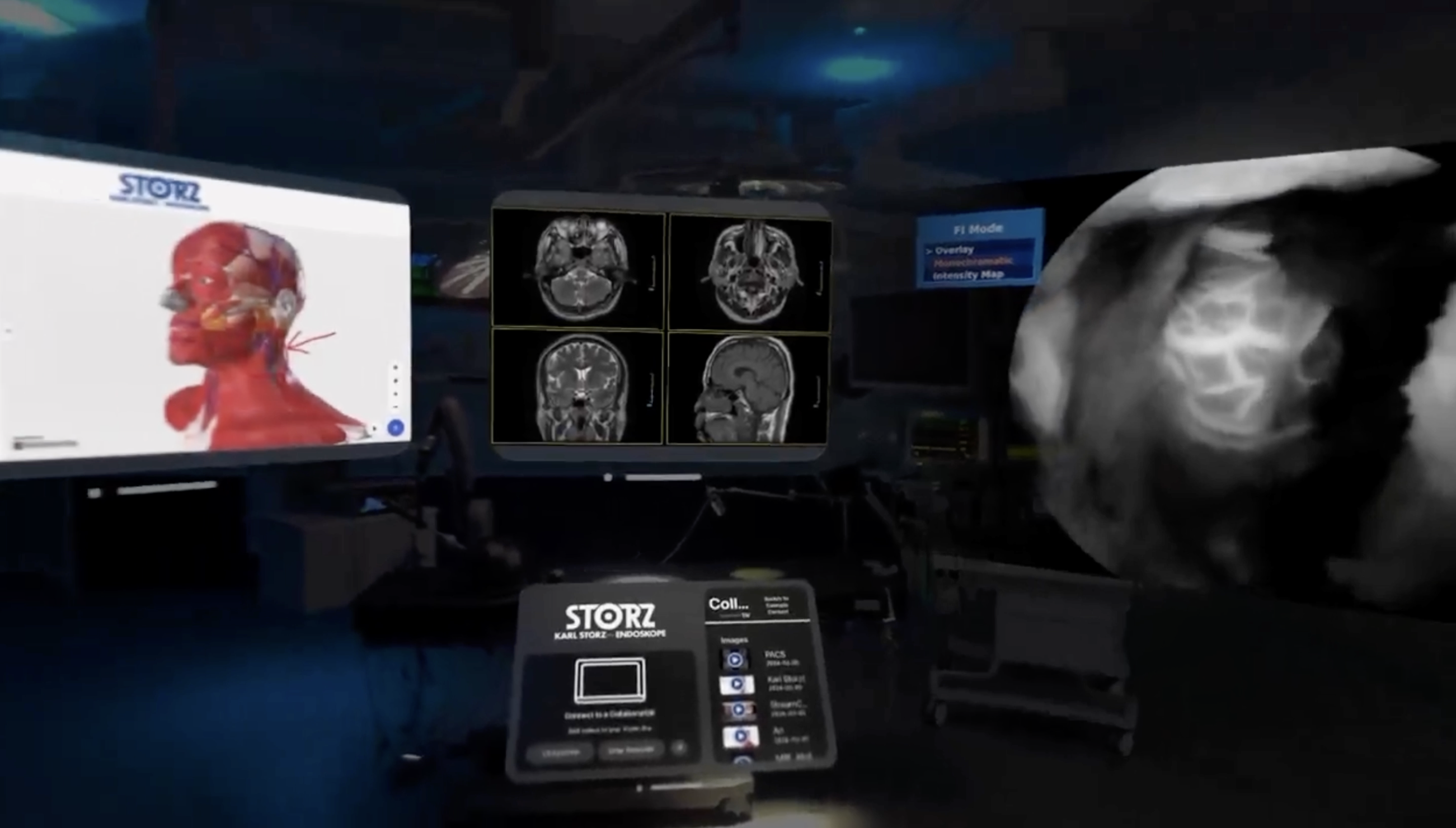 collaborator-3d-t1v-karl-storz-apple-vision-pro