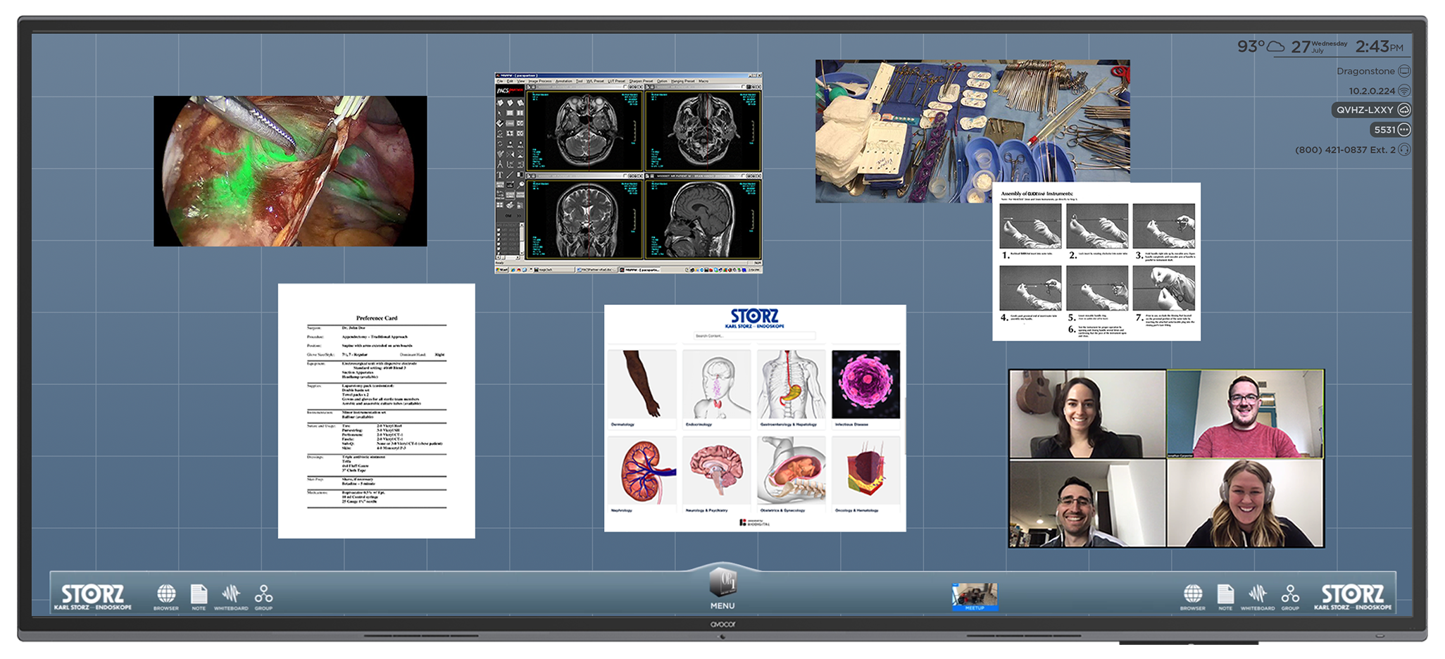 T1V KARL STORZ CollaboratOR user interface with patient visuals and case details on a 105 inch touchscreen that is used in medical operating rooms. 